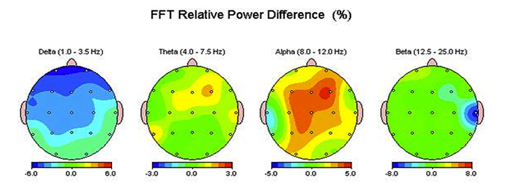 FFT Relative Power Difference